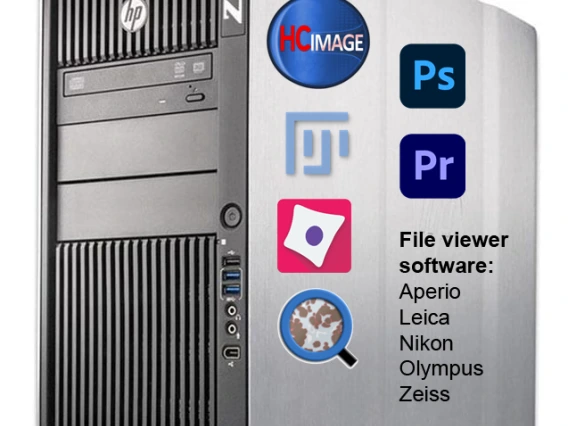 LSN image analysis