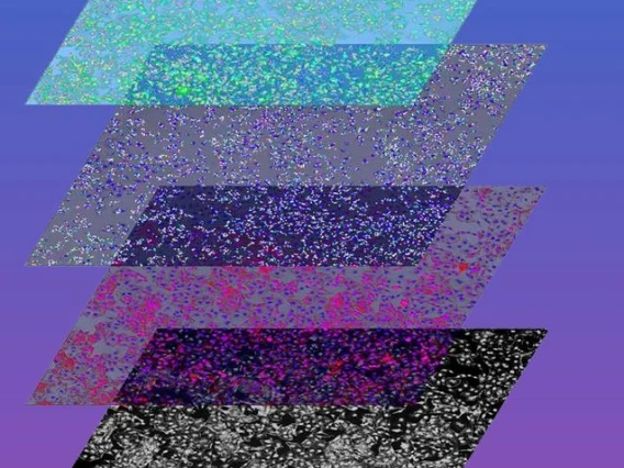 layered images of cells with fluoroescent signal