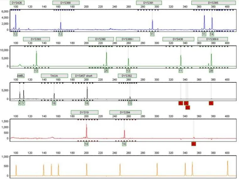 Y-Chromosome STR "multiplex" profile used for human genealogical testing at the AZGC; viewed using GeneMarker 1.85software (by SoftGenetics LLC)